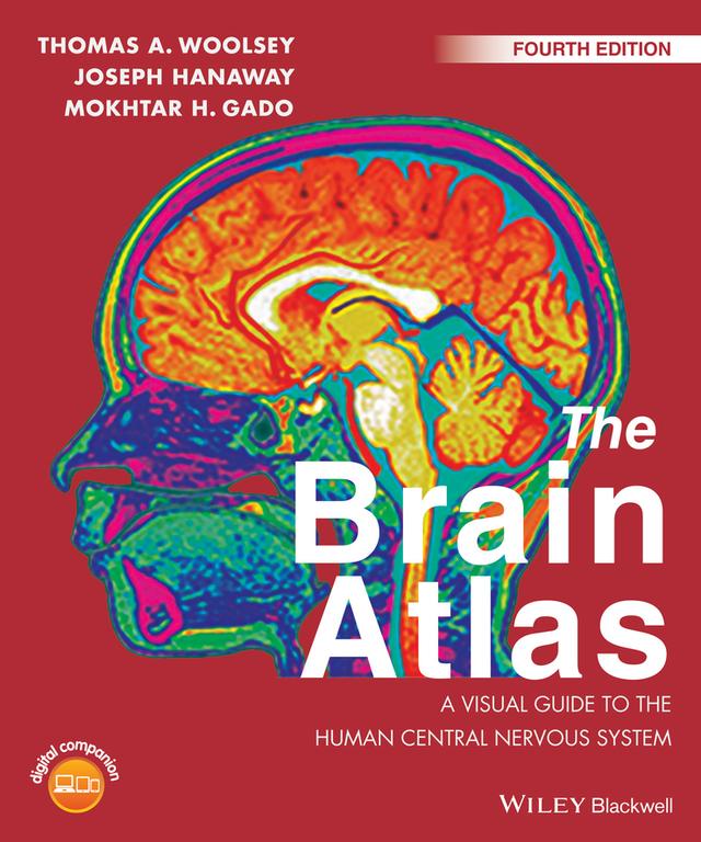 The Brain Atlas by Joseph Hanaway, Mokhtar H. Gado, Thomas A. Woolsey