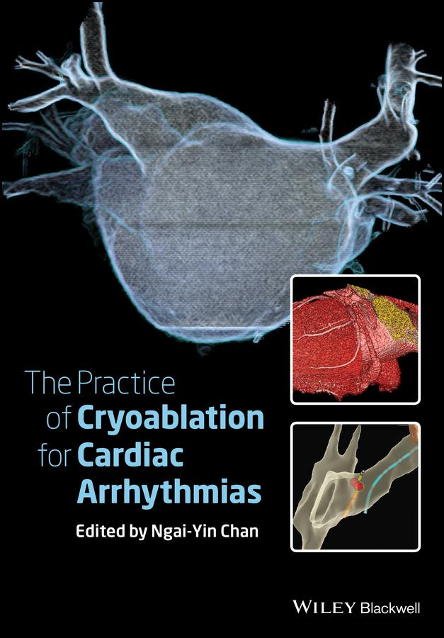 The Practice of Catheter Cryoablation for Cardiac Arrhythmias by Ngai-Yin Chan