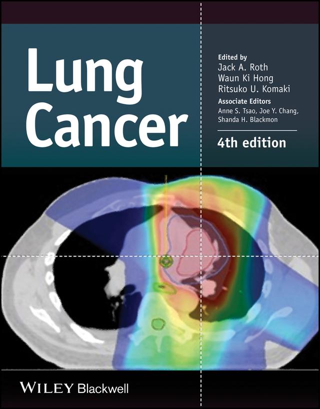 Lung Cancer by Jack A. Roth, Ritsuko U. Komaki, Waun Ki Hong