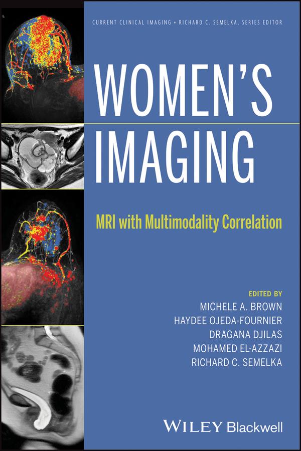 Women's Imaging by Dragana Djilas, Haydee Ojeda-Fournier, Michele A. Brown, Mohamed El-Azzazi, Richard C. Semelka