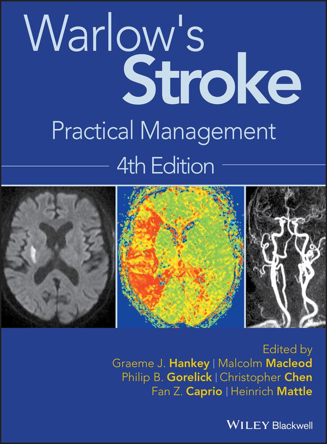 Warlow's Stroke by Christopher Chen, Fan Z. Caprio, Graeme J. Hankey, Heinrich Mattle, Malcolm Macleod, Philip B. Gorelick