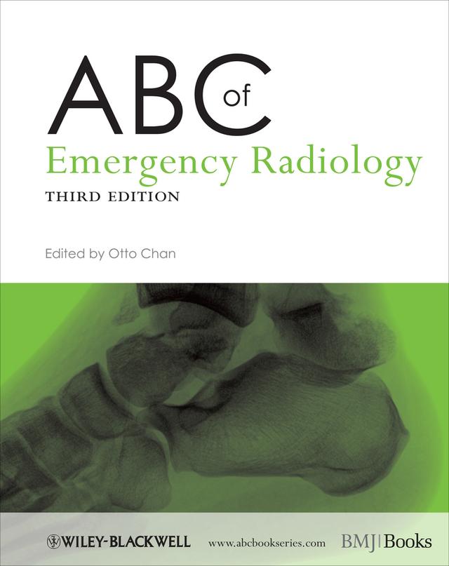 ABC of Emergency Radiology by Otto Chan