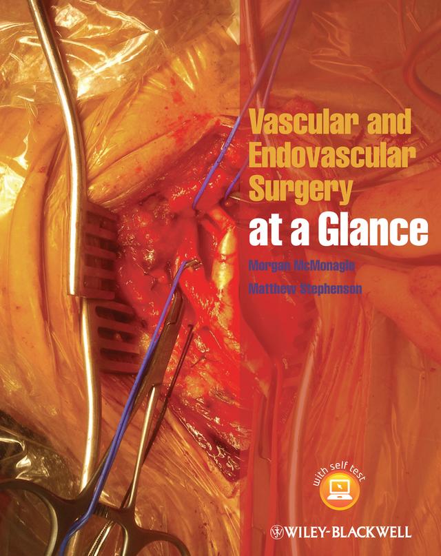 Vascular and Endovascular Surgery at a Glance by Matthew Stephenson, Morgan McMonagle