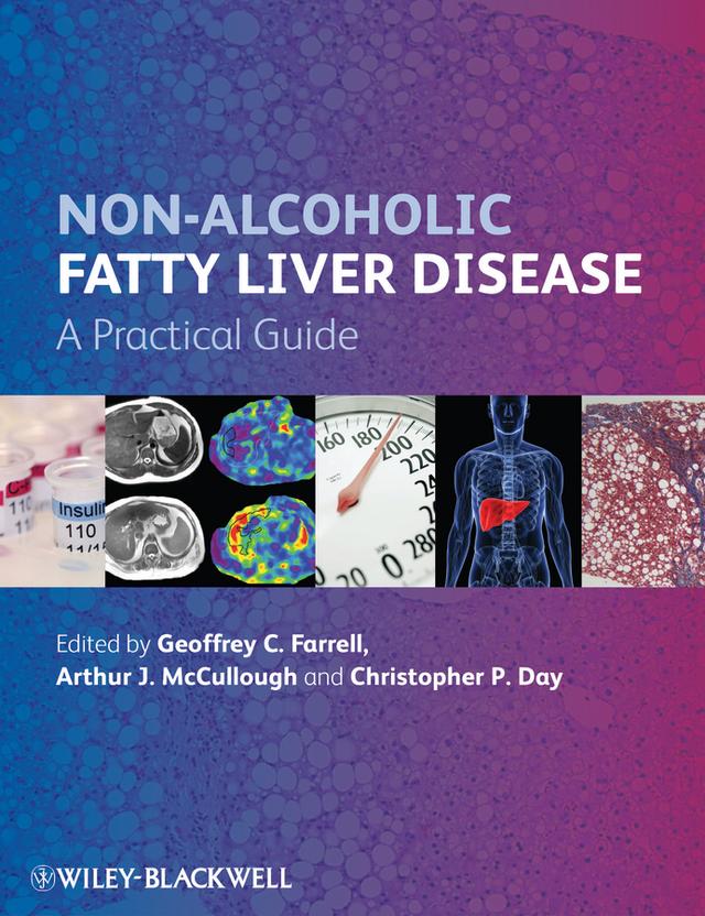 Non-Alcoholic Fatty Liver Disease by Arthur J. McCullough, Christopher P. Day, Geoffrey C. Farrell