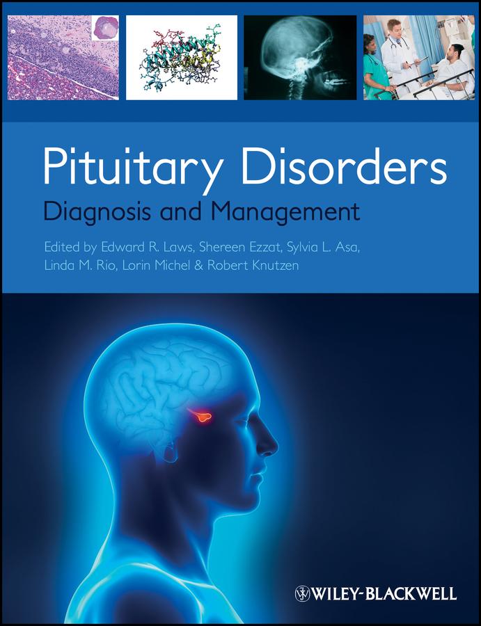 Pituitary Disorders