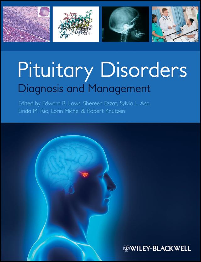 Pituitary Disorders by Edward R. Laws, Linda M. Rio, Lorin Michel, Robert Knutzen, Shereen Ezzat, Sylvia L. Asa
