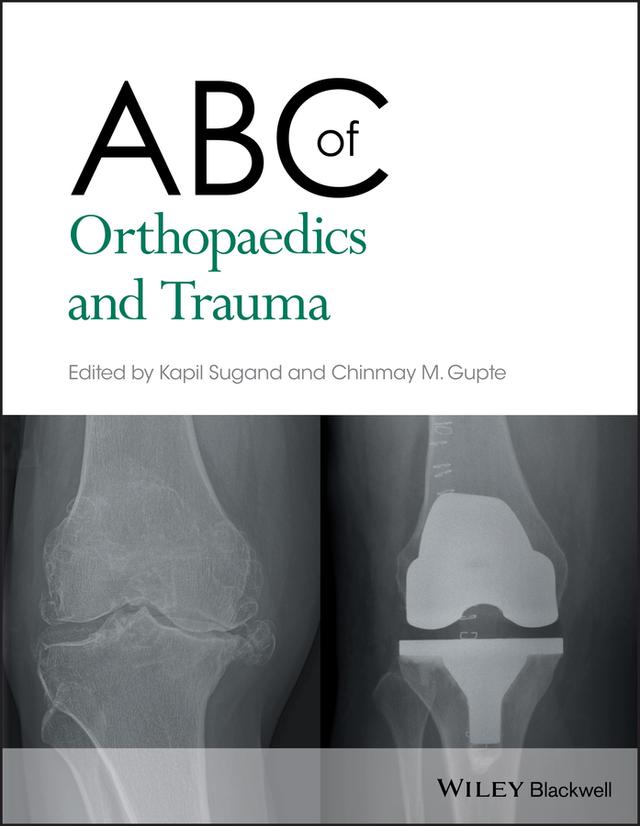 ABC of Orthopaedics and Trauma by Chinmay M. Gupte, Kapil Sugand