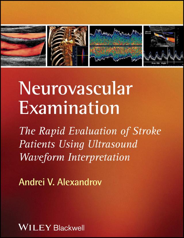 Neurovascular Examination by Andrei V. Alexandrov