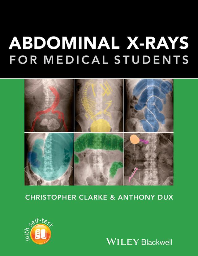 Abdominal X-rays for Medical Students by Anthony Dux, Christopher Clarke