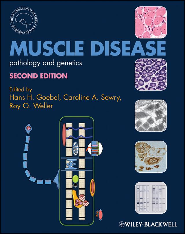 Muscle Disease by Caroline A. Sewry, Hans H. Goebel, Roy O. Weller