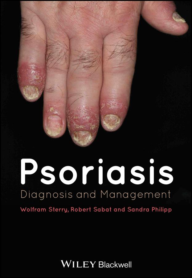 Psoriasis by Robert Sabat, Sandra Philipp, Wolfram Sterry