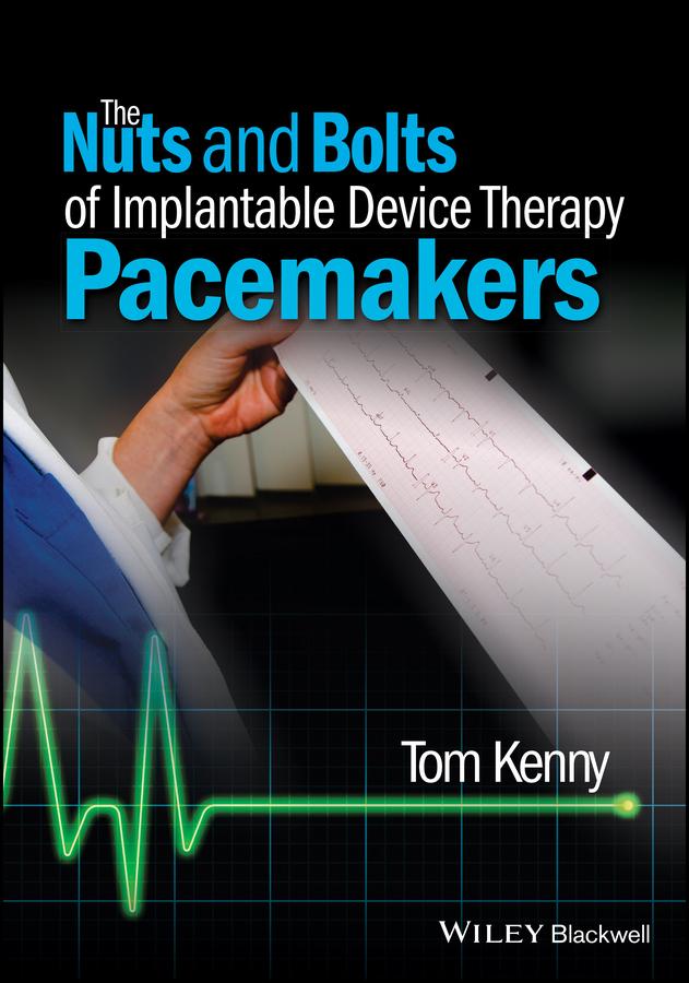The Nuts and Bolts of Implantable Device Therapy by Tom Kenny