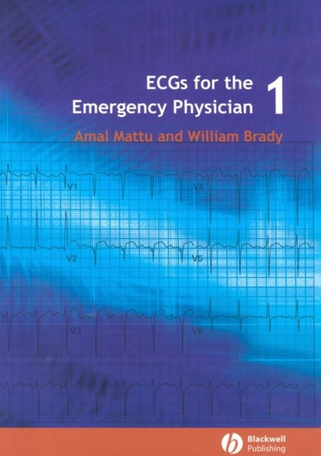 ECGs for the Emergency Physician 1 by Amal Mattu, William J. Brady