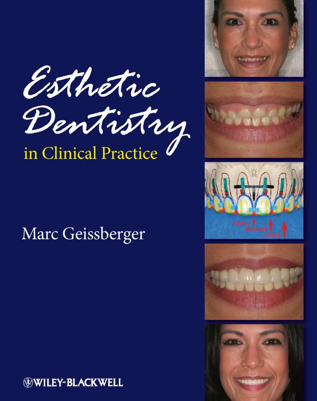 Esthetic Dentistry in Clinical Practice by Marc Geissberger