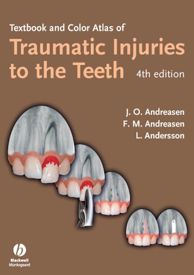 Textbook and Color Atlas of Traumatic Injuries to the Teeth by Frances M. Andreasen, Jens O. Andreasen, Lars Andersson