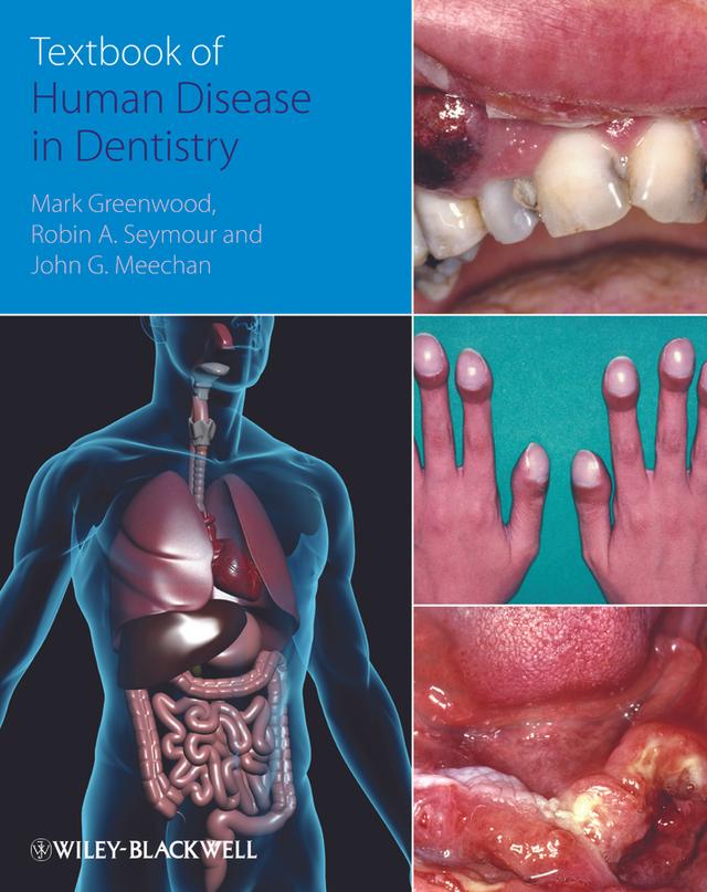 Textbook of Human Disease in Dentistry by John Meechan, Mark Greenwood, Robin Seymour
