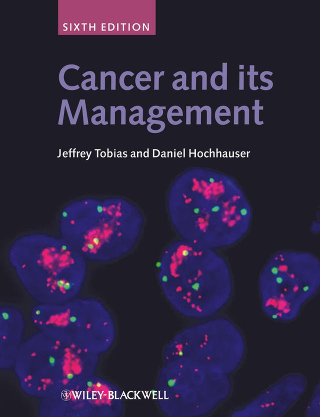 Cancer and its Management by Daniel Hochhauser, Jeffrey S. Tobias