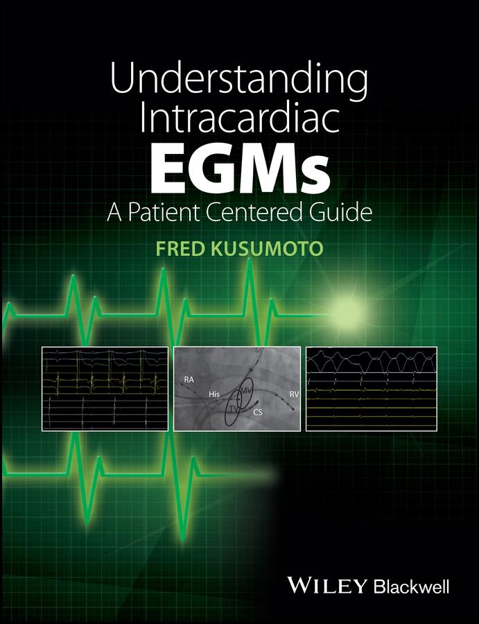 Understanding Intracardiac EGMs