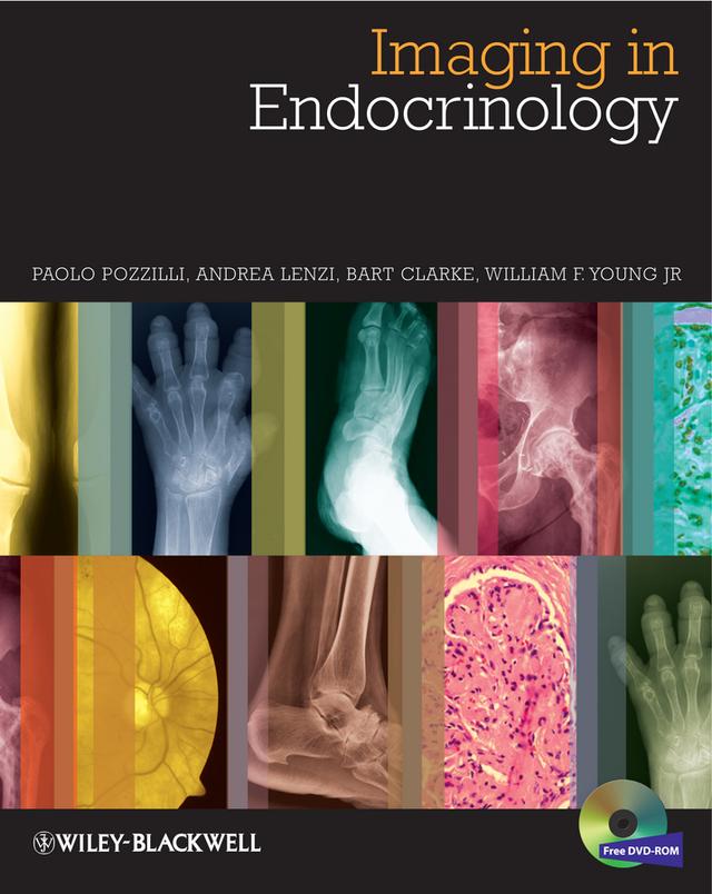 Imaging in Endocrinology by Andrea Lenzi, Bart L. Clarke, Paolo Pozzilli, William F. Young, Jr.