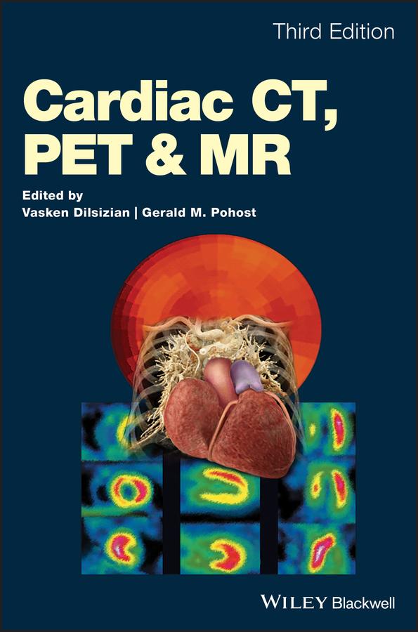 Cardiac CT, PET and MR by Gerald M. Pohost, Vasken Dilsizian
