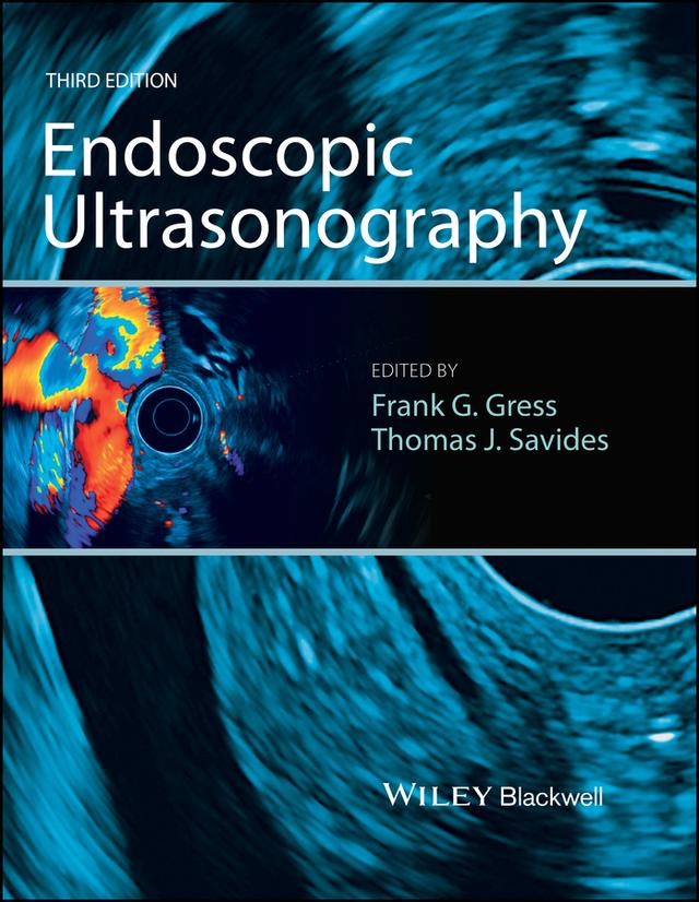 Endoscopic Ultrasonography by Frank G. Gress, Thomas J. Savides