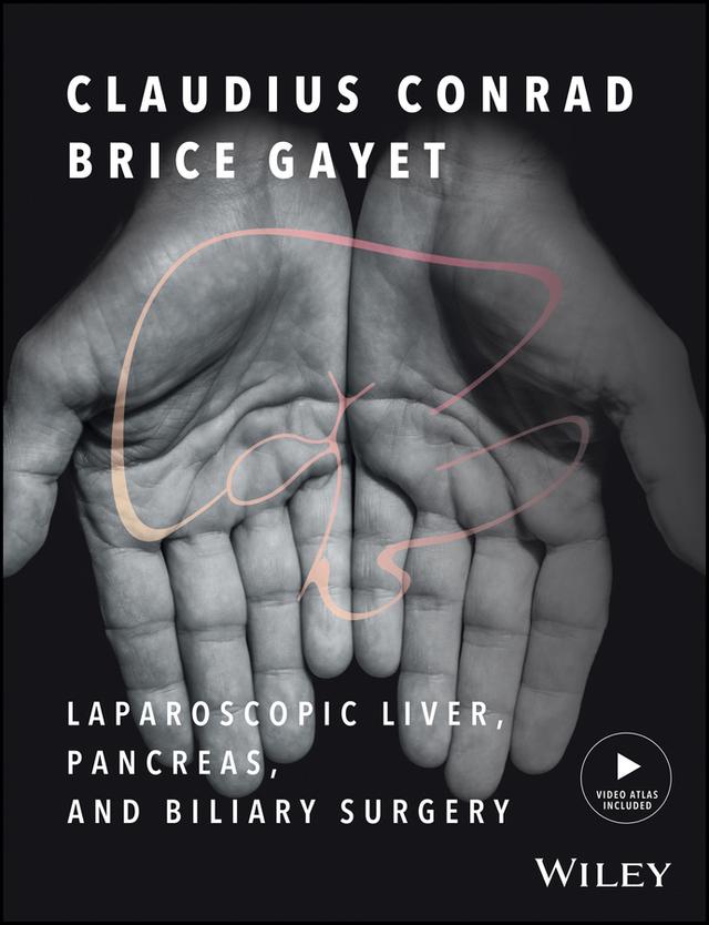 Laparoscopic Liver, Pancreas, and Biliary Surgery by Brice Gayet, Claudius Conrad