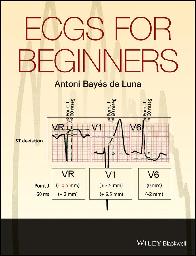 ECGs for Beginners by Antoni Bayés de Luna