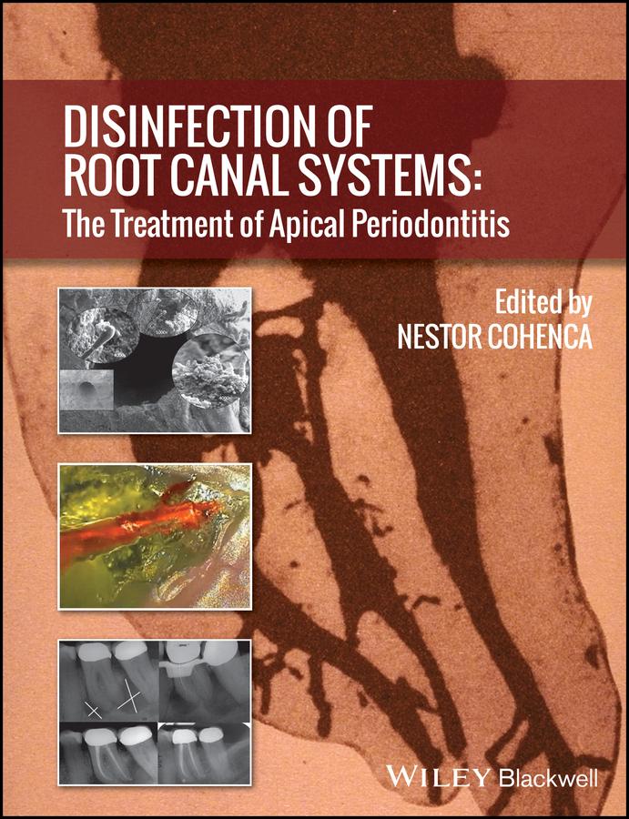 Disinfection of Root Canal Systems
