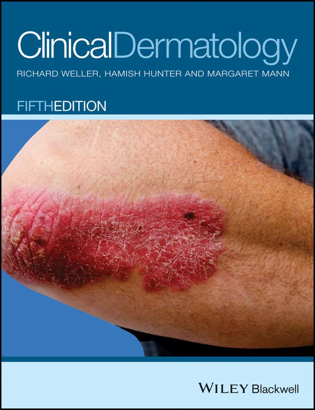 Clinical Dermatology by Hamish J. A. Hunter, Margaret W. Mann, Richard B. Weller