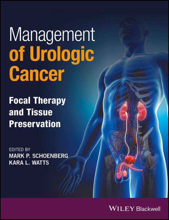 Management of Urologic Cancer by Kara L. Watts, Mark P. Schoenberg