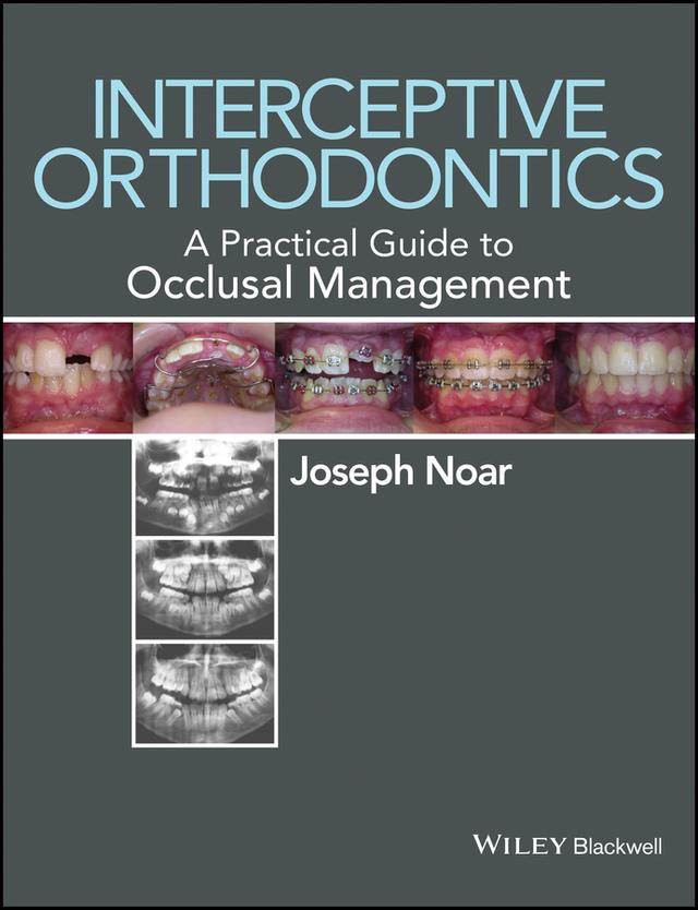 Interceptive Orthodontics by Joseph Noar