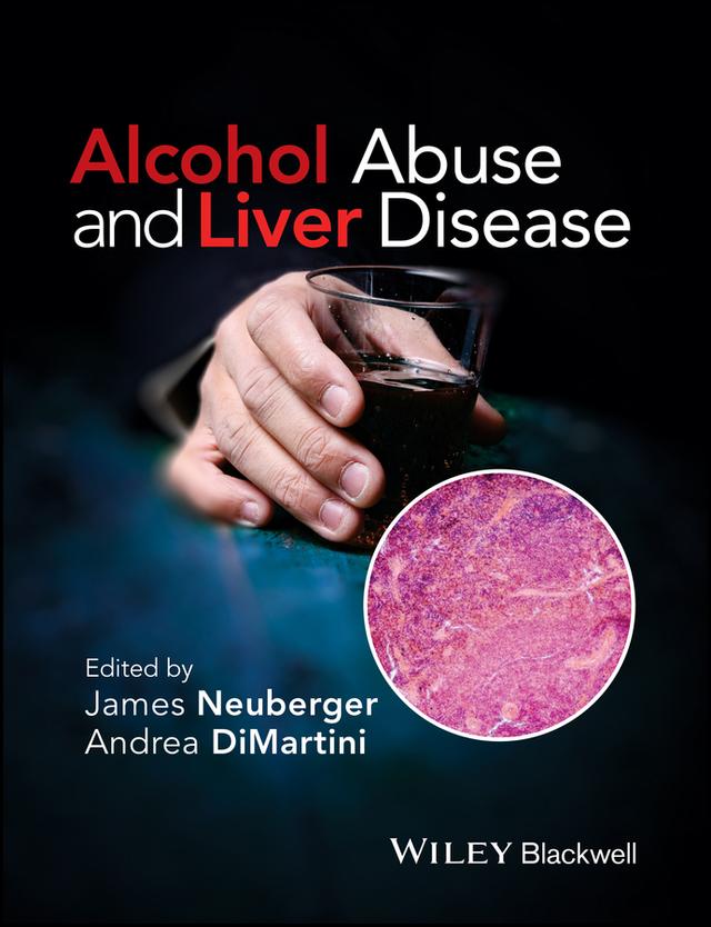 Alcohol Abuse and Liver Disease by Andrea DiMartini, James Neuberger