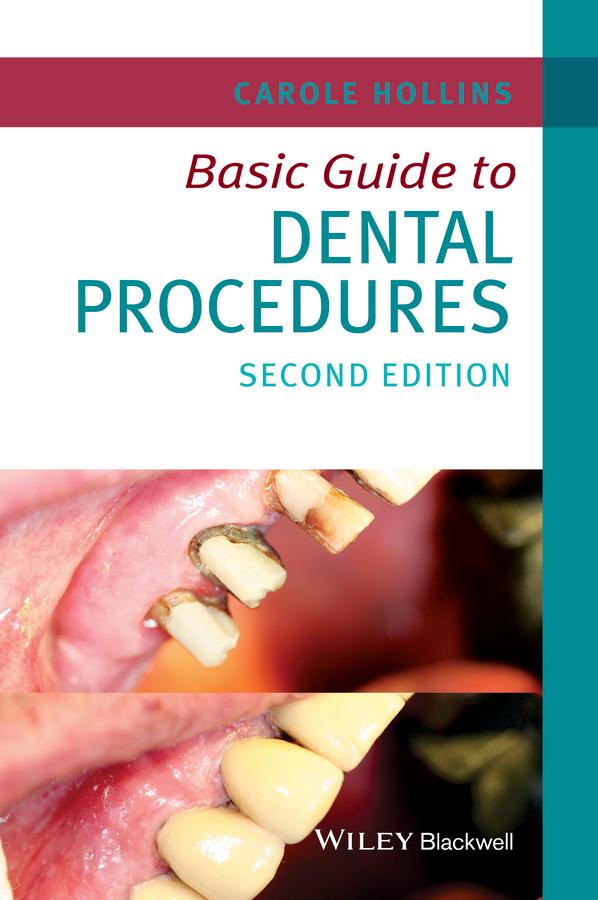 Basic Guide to Dental Procedures by Carole Hollins