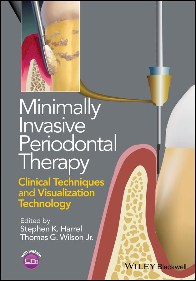 Minimally Invasive Periodontal Therapy by Stephen K. Harrel, Thomas G. Wilson, Jr.