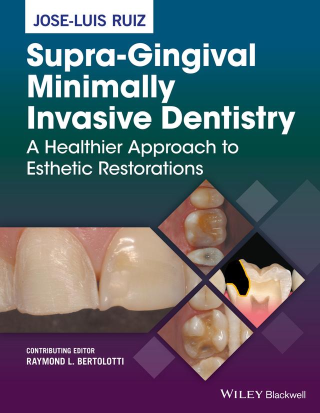 Supra-Gingival Minimally Invasive Dentistry by Jose-Luis Ruiz