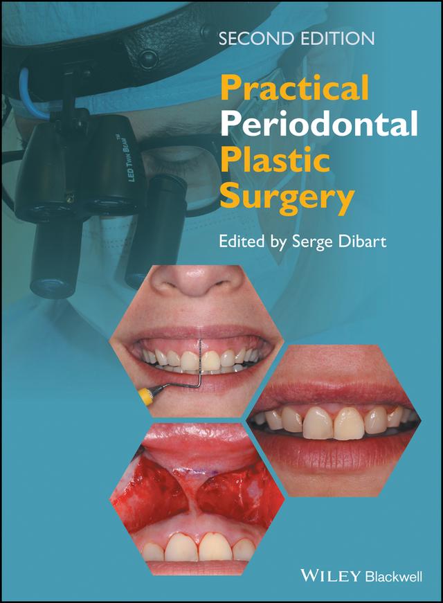 Practical Periodontal Plastic Surgery by Serge Dibart