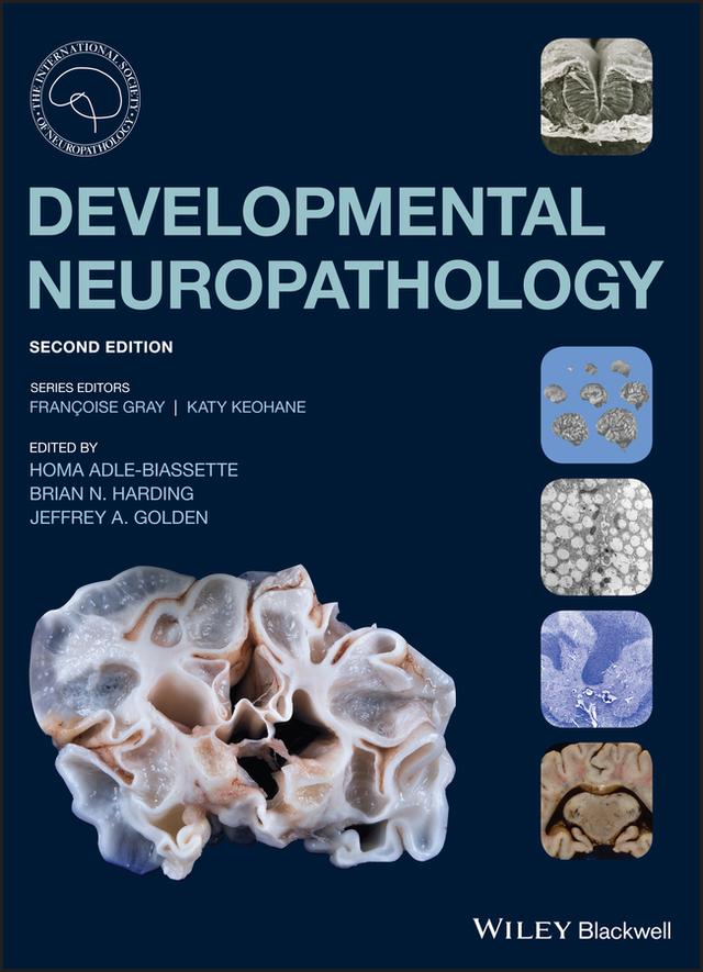 Developmental Neuropathology by Brian N. Harding, Francoise Gray, Homa Adle-Biassette, Jeffrey A. Golden, Katy Keohane