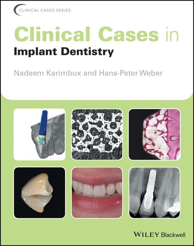 Clinical Cases in Implant Dentistry by Hans-Peter Weber, Nadeem Karimbux