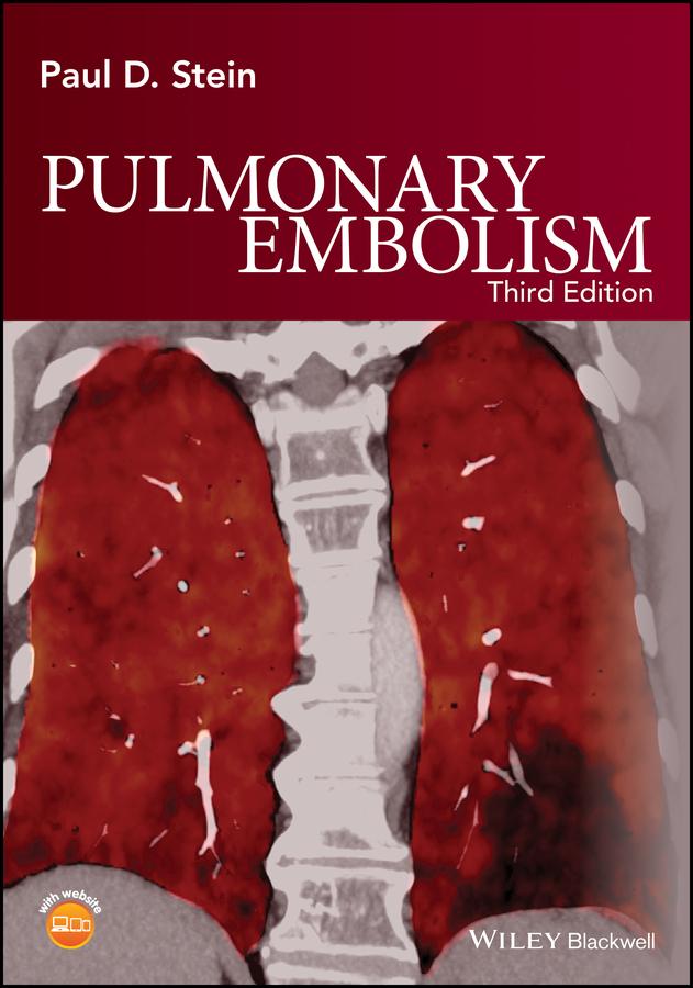 Pulmonary Embolism by Paul D. Stein