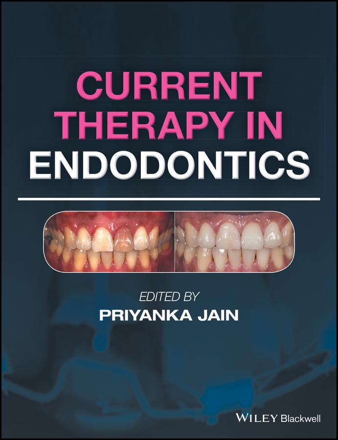 Current Therapy in Endodontics
