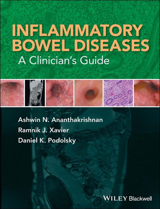 Inflammatory Bowel Diseases by Ashwin N. Ananthakrishnan, Daniel K. Podolsky, Ramnik J. Xavier