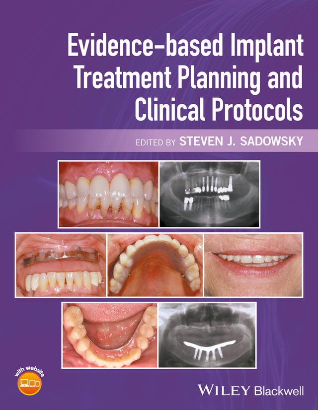 Evidence-based Implant Treatment Planning and Clinical Protocols by Steven J. Sadowsky