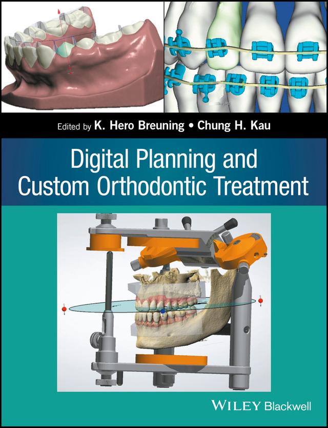 Digital Planning and Custom Orthodontic Treatment by Chung H. Kau, K. Hero Breuning