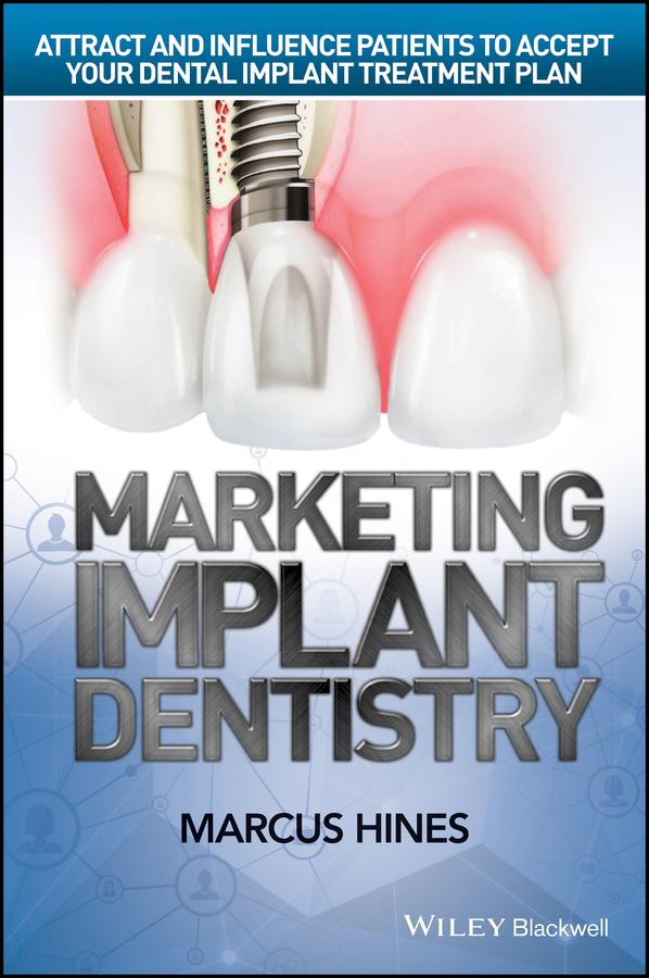 Marketing Implant Dentistry