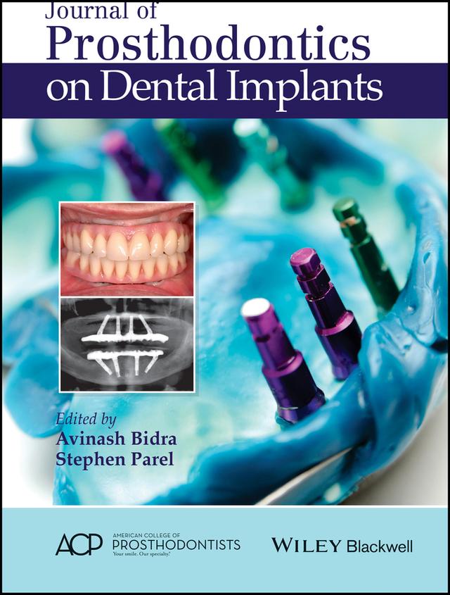 Journal of Prosthodontics on Dental Implants by Avinash Bidra, Stephen Parel