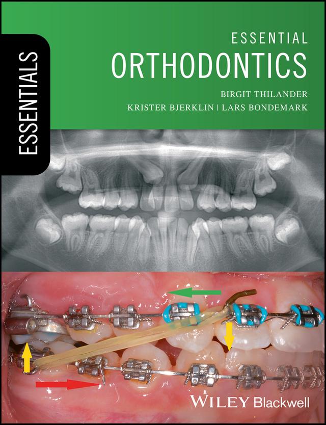 Essential Orthodontics by Birgit Thilander, Krister Bjerklin, Lars Bondemark