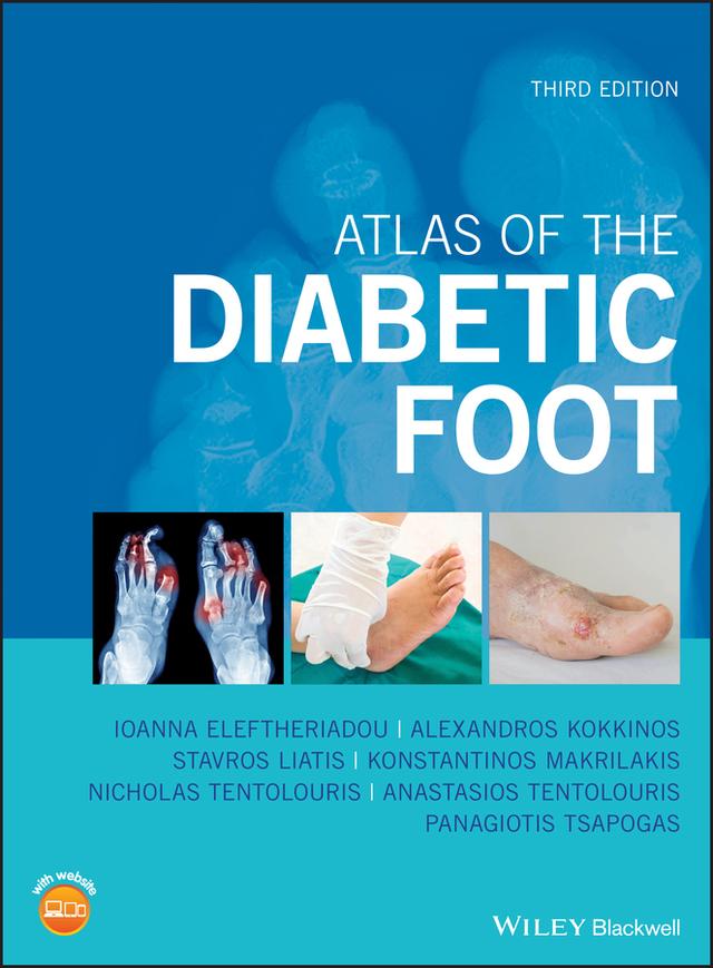 Atlas of the Diabetic Foot by Alexandros Kokkinos, Anastasios Tentolouris, Ioanna Eleftheriadou, Konstantinos Makrilakis, Nicholas Tentolouris, Panagiotis Tsapogas, Stavros Liatis