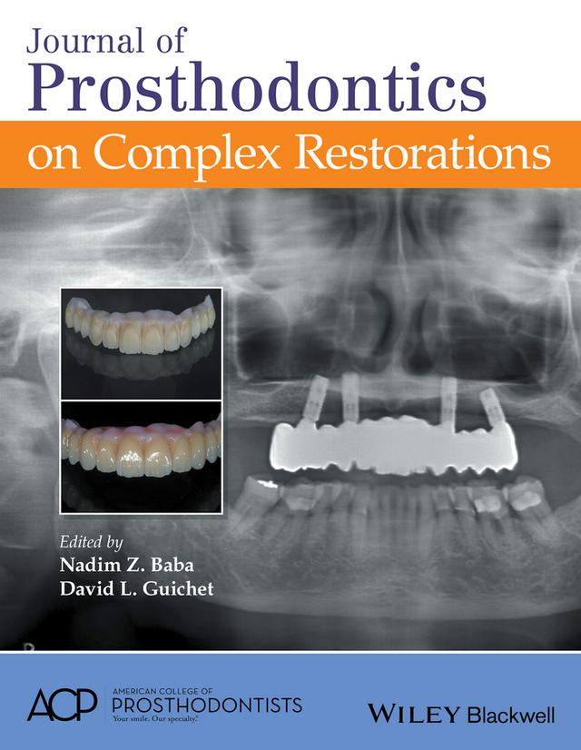 Journal of Prosthodontics on Complex Restorations by David L. Guichet, Nadim Z. Baba