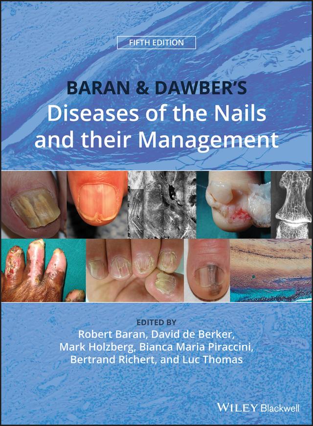 Baran and Dawber's Diseases of the Nails and their Management by Bertrand Richert, Bianca Maria Piraccini, David A. R. de Berker, Luc Thomas, Mark Holzberg, Robert Baran