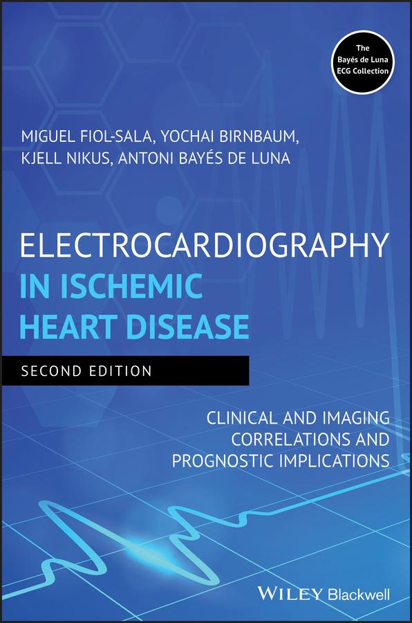 Electrocardiography in Ischemic Heart Disease by Antoni Bayés de Luna, Kjell Nikus, Miquel Fiol-Sala, Yochai Birnbaum